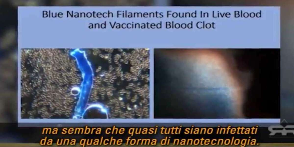 I vaccini Covid sono pieni di metalli rari per produrre ogni tipo di nanotecnologia