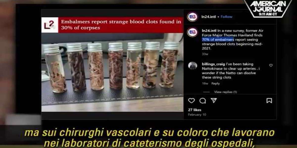 Confermano che i coaguli bianchi fibrosi salgono alle stelle dopo le iniezioni covid-19.