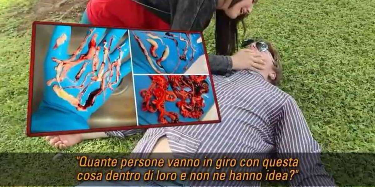 Coaguli bianchi trovati da imbalsamatori e chirurghi