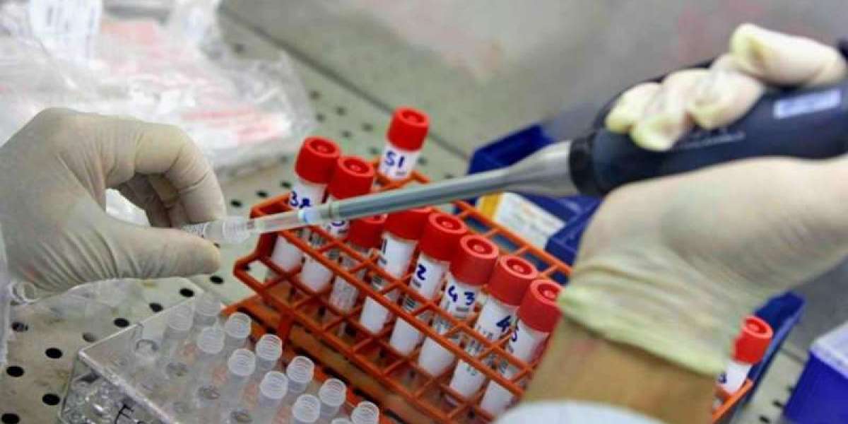 Commissione UE ha bloccato i controlli sui test del vaccino contro il coronavirus